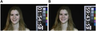 Focusing on Mouth Movement to Improve Genuine Smile Recognition